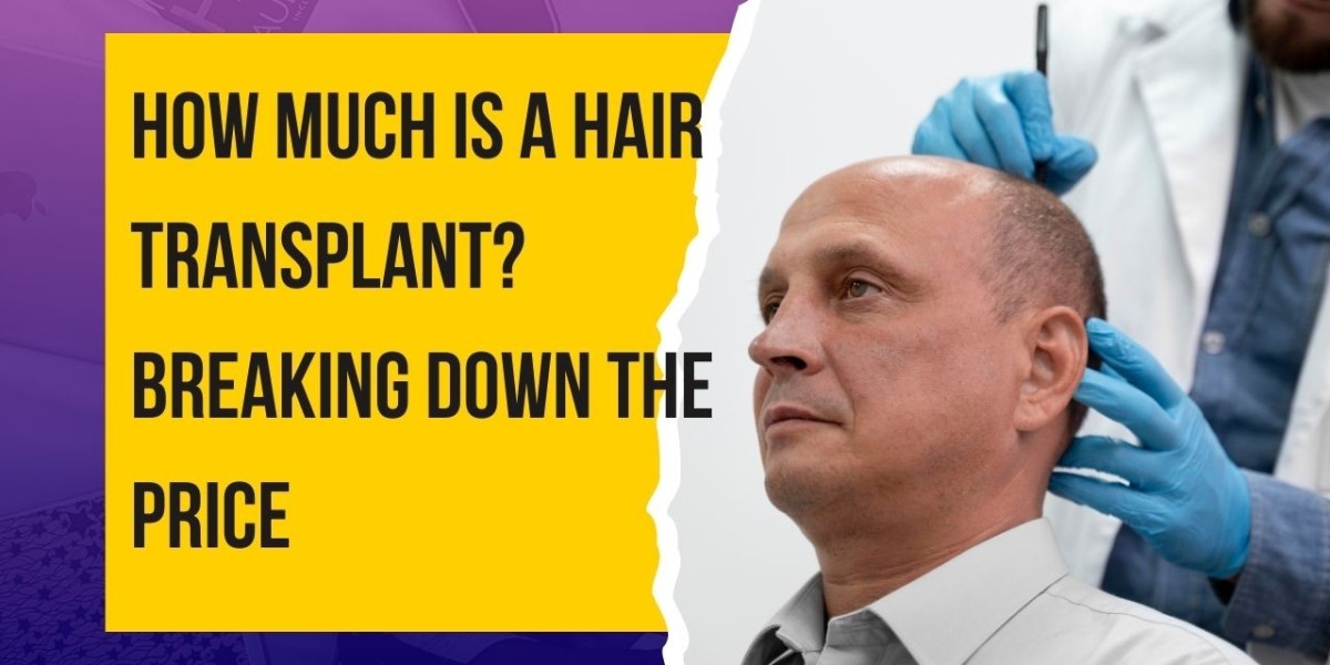 How Much is a Hair Transplant? Breaking Down the Price