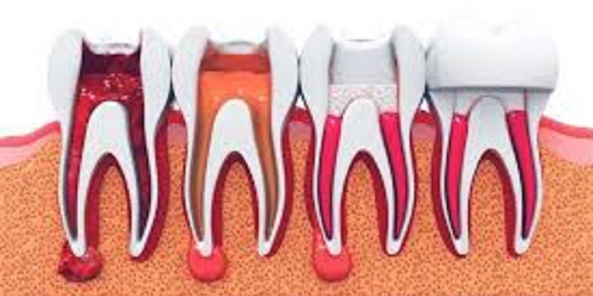 Orthodontist in adliya