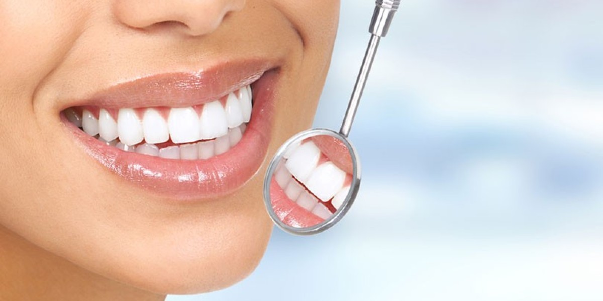 Top-Rated Teeth Cleaning in Monte Vista: Same Day Dental Implants, Emergency Dentistry & More