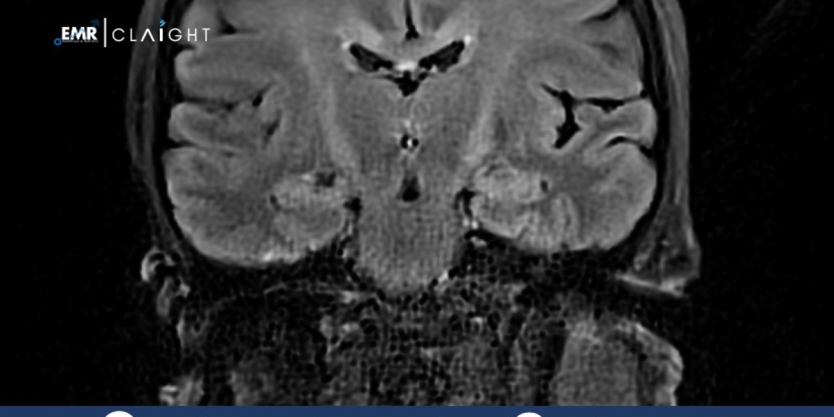 Amnestic Disorders Therapeutics Market Outlook 2025–2034