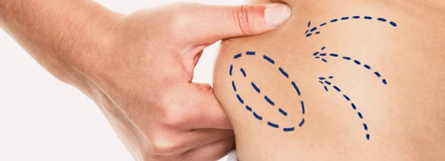 Liposuction Surgery Cover Image