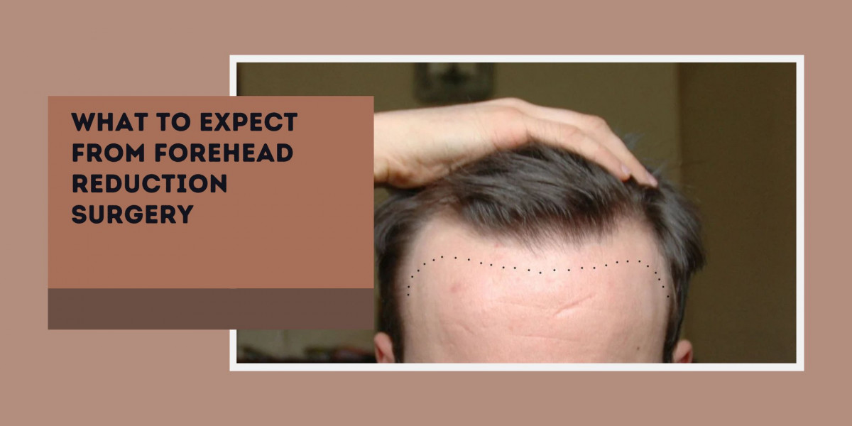 What to Expect From Forehead Reduction Surgery