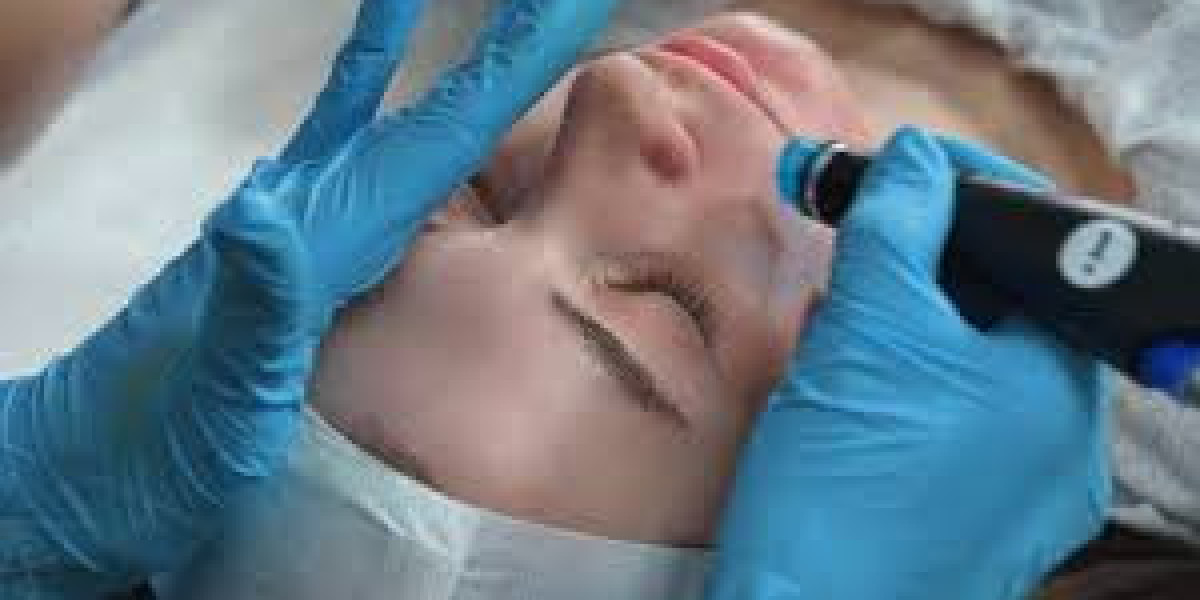 Electrolysis scarborough queen street east toronto