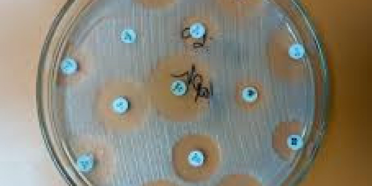 Antimicrobial Susceptibility Test Market trends driving commercialization of rapid and automated testing platforms globa