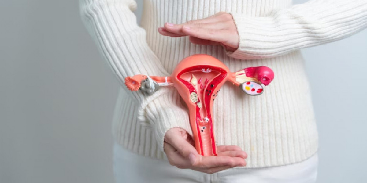 How Oncologists Personalize Ovarian Cancer Care