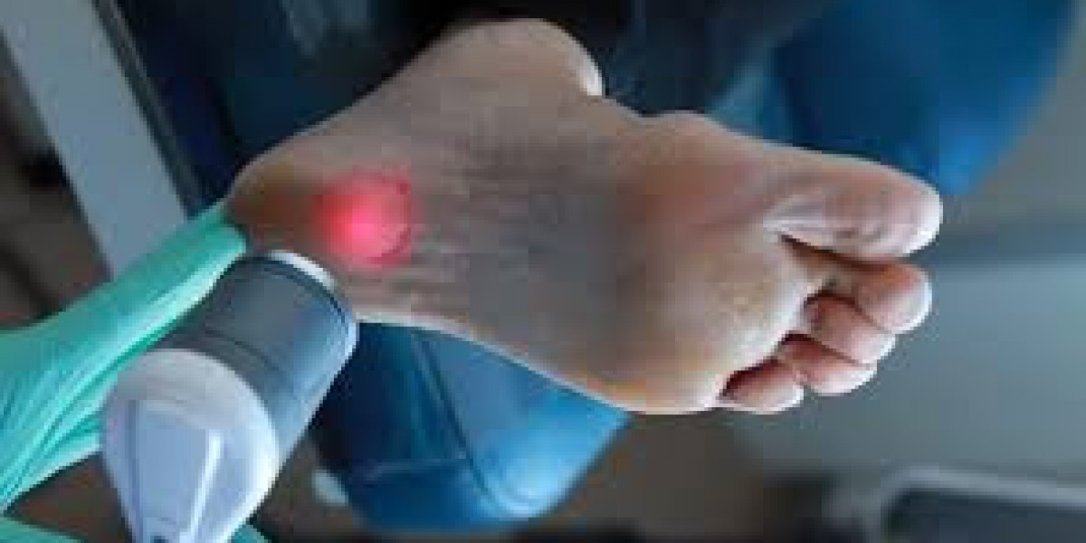 Laser Treatment for Plantar Fasciitis: A Modern Path to Fast Heel Pain Relief