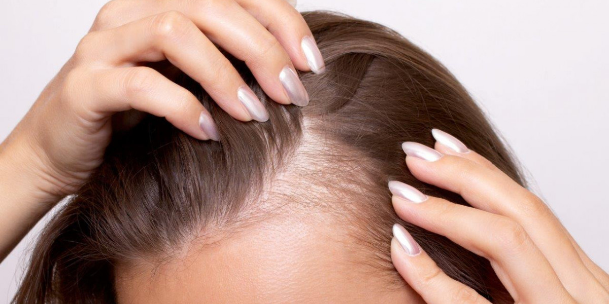 Understanding Modern Hair Restoration: Your Complete Guide