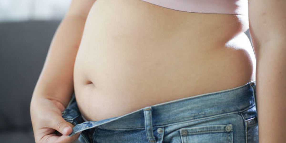 Combining Tummy Tuck Surgery with Exercise