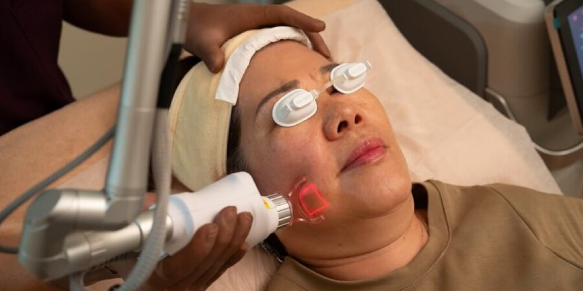 Fractional CO2 Laser Treatment for Crepey Skin