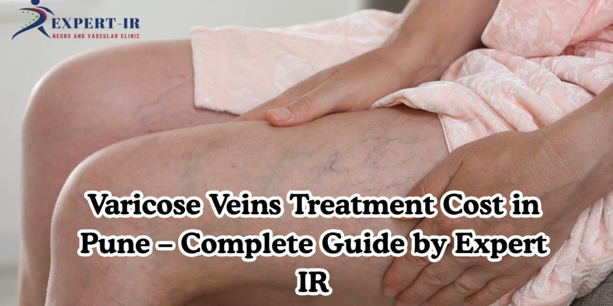 Varicose Veins Treatment Cost in Pune – Complete Price & Procedure Guide by Expert IR