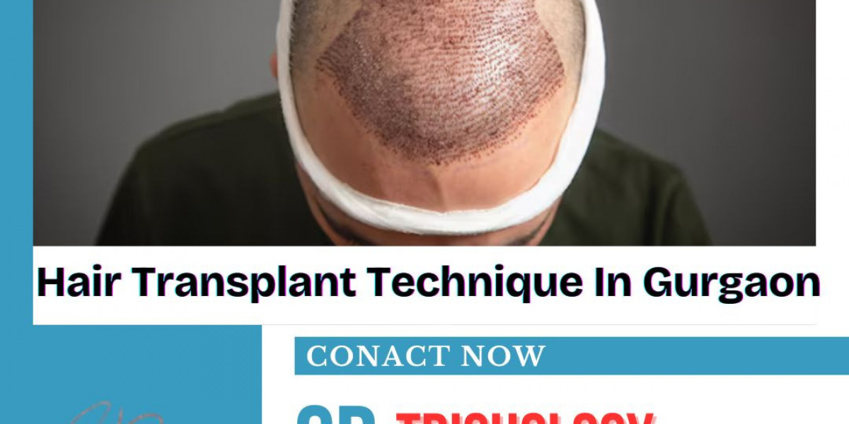 Why Hair Density Matters More Than Graft Count