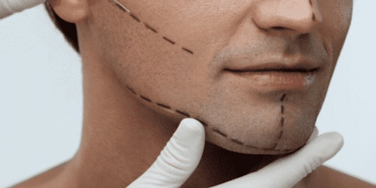 Jaw Surgery in Islamabad – Precision and Care
