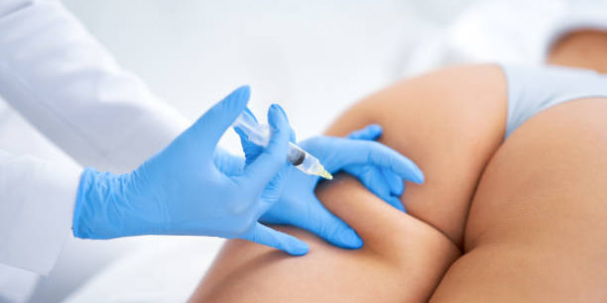 Sculptra Injections Compared to Radiesse for Jawline and Cheeks