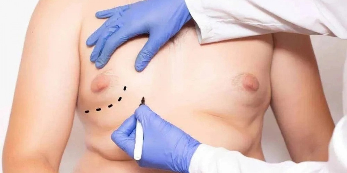 Gynecomastia Surgery in Islamabad – A Confident New You