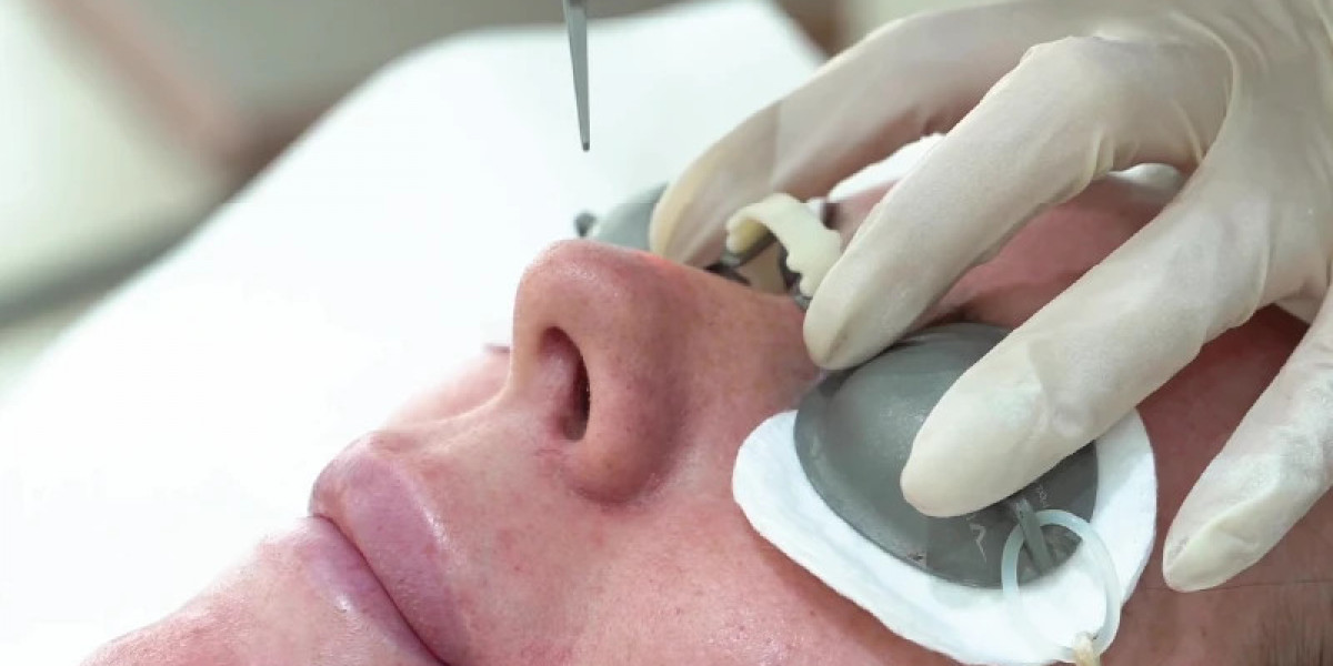 Can Picosure Laser Treatment Rejuvenate Complexion Naturally?