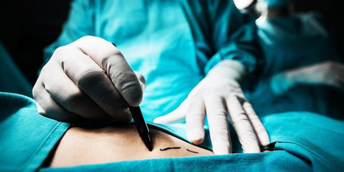 Bariatric Surgery Cost Pathway Guiding a More Balanced Mindset