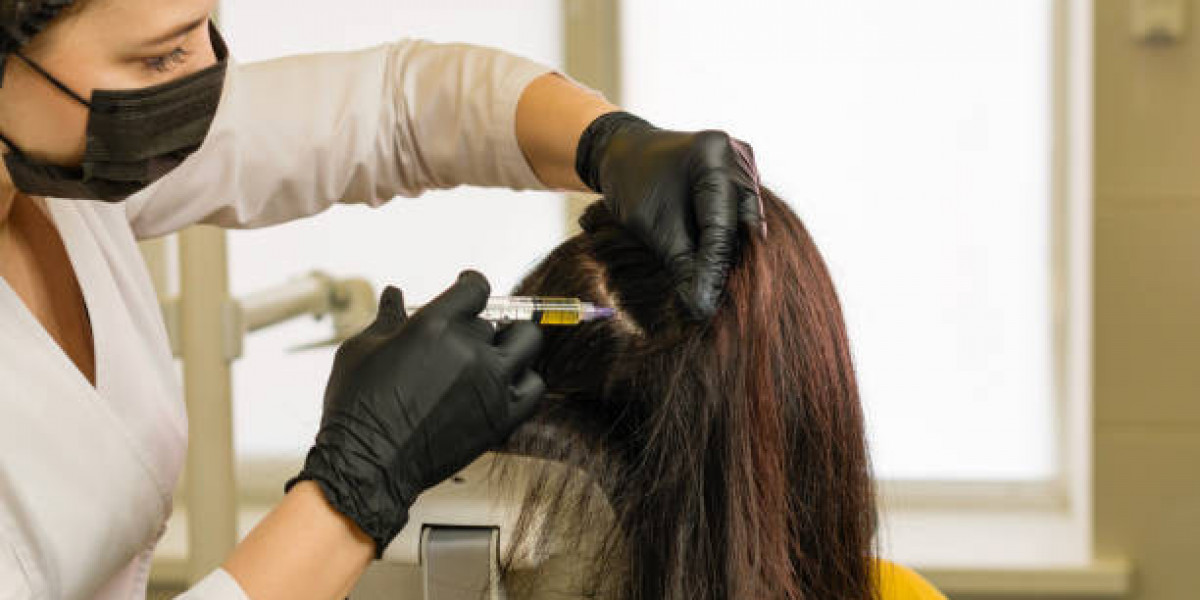 PRP Hair Treatment for Managing Hair Thinning Effectively