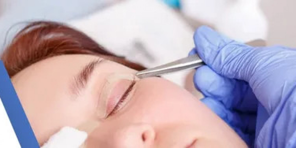 Eyelid Lift in Islamabad – Advanced Surgical Techniques